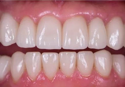 Before and after image 2