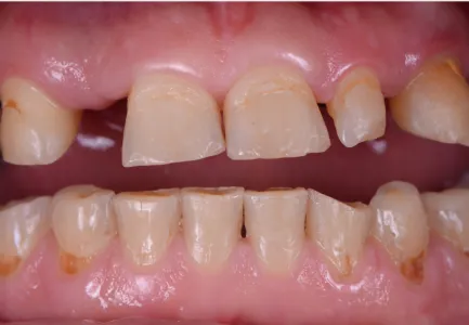 Before and after image 1