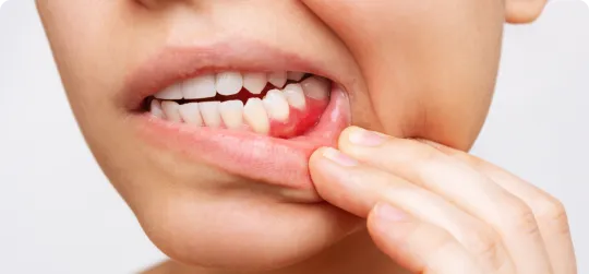 Periodontics at Encinitas Dental Design in Encinitas, California